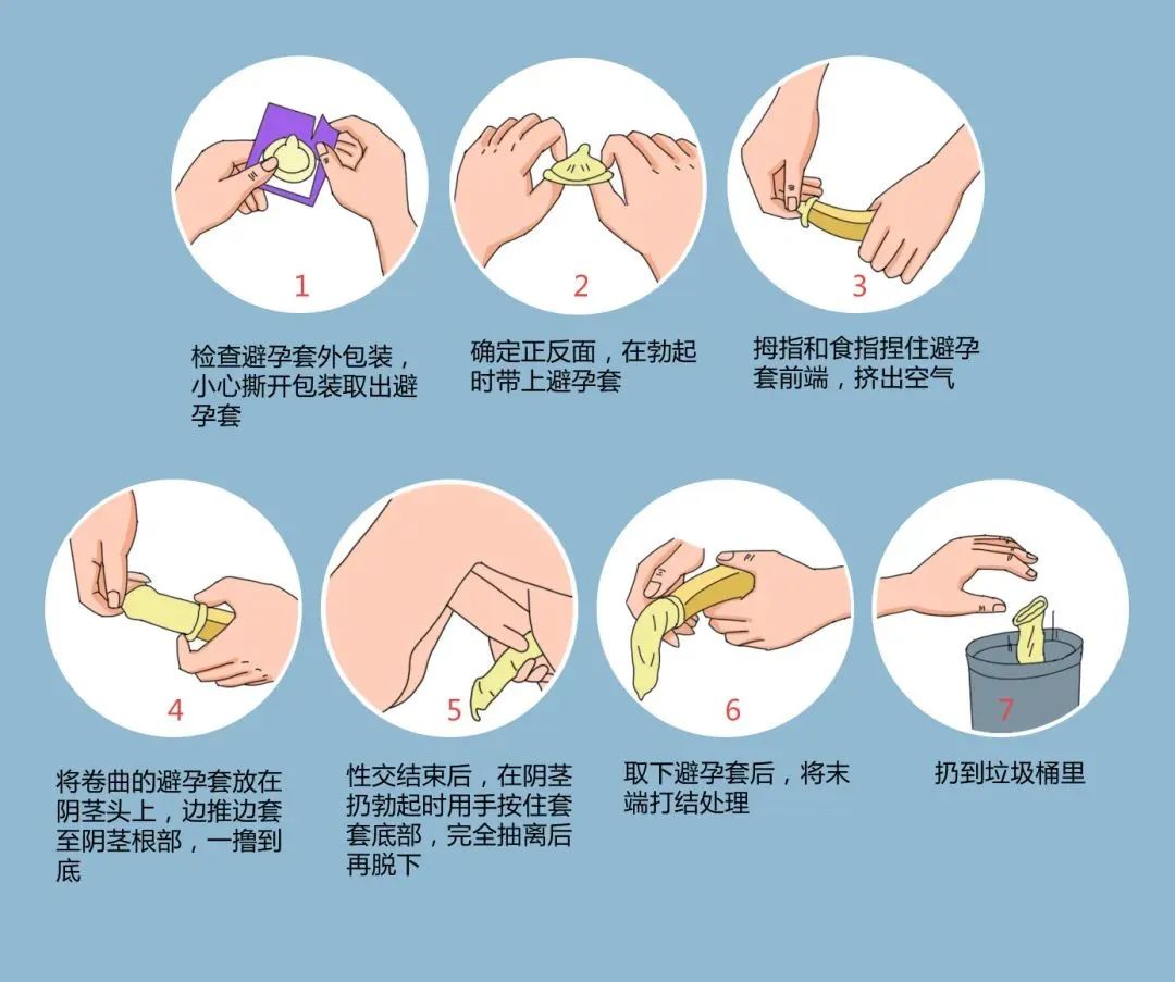 年輕人成艾滋病重災區(qū)，正確戴套很有必要.jpg